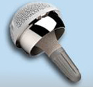 The Birmingham Mid Head Resection (BMHR)