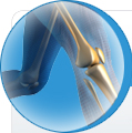 Birmingham Hip Resurfacing