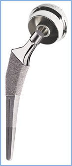 Total Hip Replacement