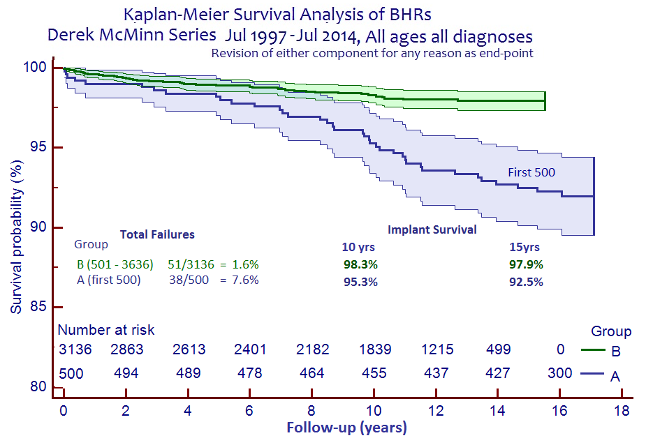 Analysis showing an impressive 97.9% implant survival at fifteen years and a clear learning curve of 1000 cases for Hip Resurfacings