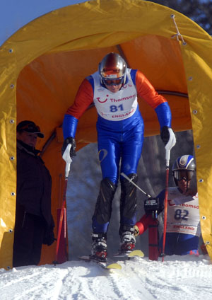 skiing hip resurfacing colin tucker