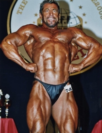 hip resurfacing body builder